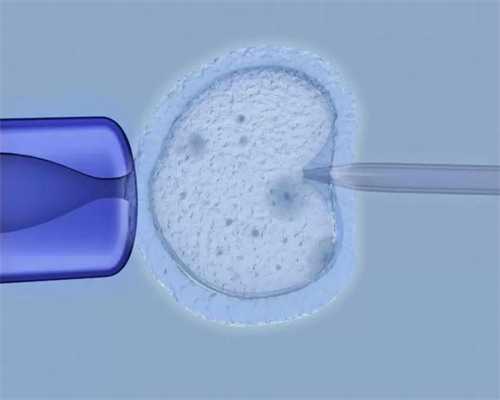 山东供卵三代生男孩医院如何？2026山东借卵生子费用明细公布